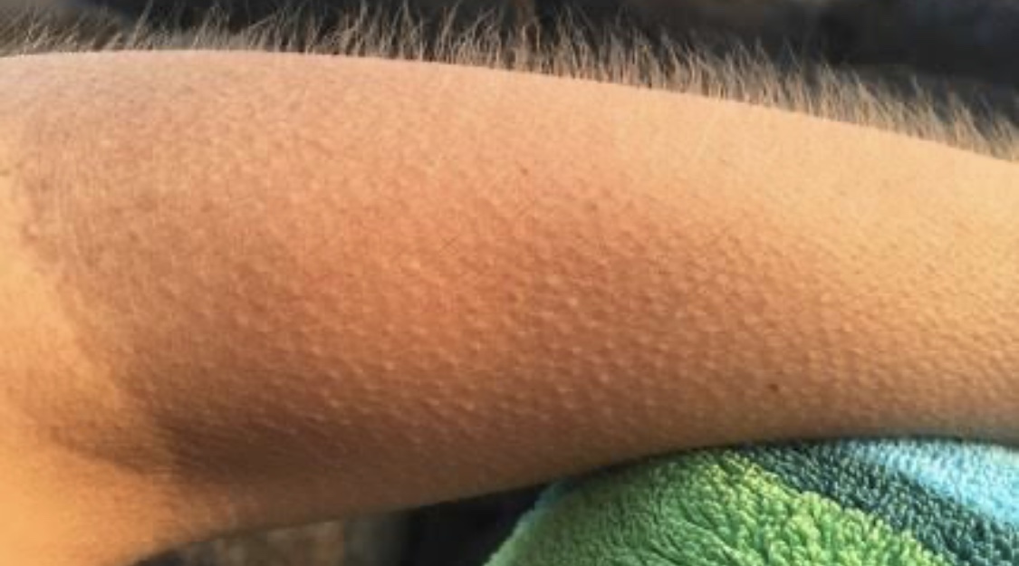 Piloetection.. what an awesome&nbsp;word!